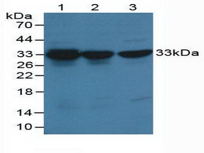 CDK2 Antibody - Western Blot; Sample: Lane1: Human Hela Cells; Lane2: Human Hepg2 Cells; Lane3: Human K-562 Cells.