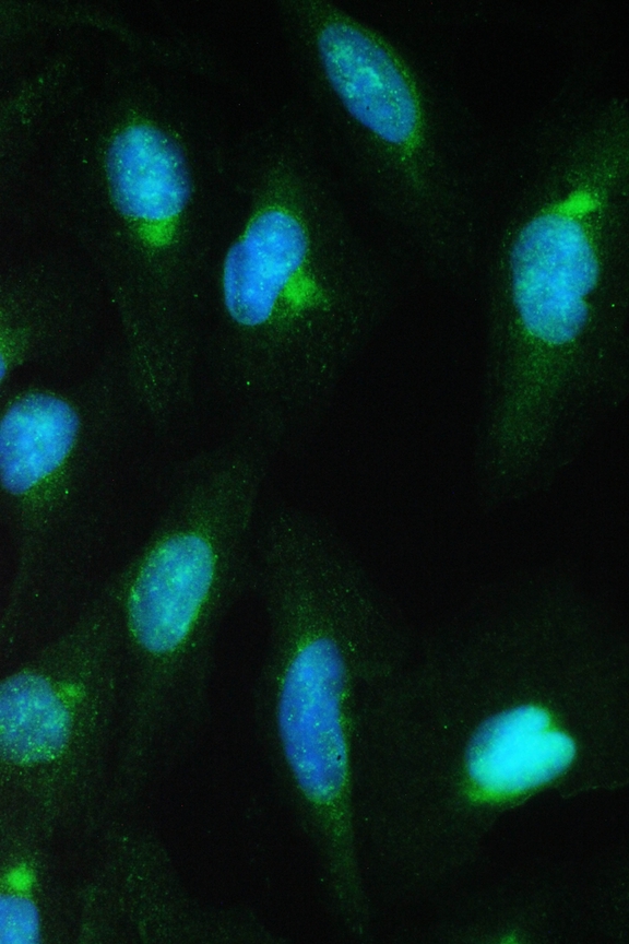 CDK2 Antibody - IF analysis of Cdk2 using anti-Cdk2 antibody Cdk2 was detected in immunocytochemical section of U20S cell. Enzyme antigen retrieval was performed using IHC enzyme antigen retrieval reagent for 15 mins. The tissue section was blocked with 10% goat serum. The tissue section was then incubated with 2µg/mL rabbit anti-Cdk2 Antibody overnight at 4°C. DyLight®488 Conjugated Goat Anti-Rabbit IgG was used as secondary antibody at 1:100 dilution and incubated for 30 minutes at 37°C. The section was counterstained with DAPI. Visualize using a fluorescence microscope and filter sets appropriate for the label used.