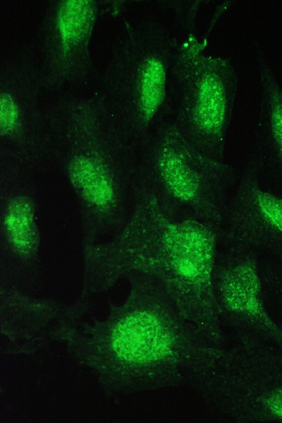 CDK2 Antibody - IF analysis of Cdk2 using anti-Cdk2 antibody Cdk2 was detected in immunocytochemical section of U20S cell. Enzyme antigen retrieval was performed using IHC enzyme antigen retrieval reagent for 15 mins. The tissue section was blocked with 10% goat serum. The tissue section was then incubated with 2µg/mL rabbit anti-Cdk2 Antibody overnight at 4°C. DyLight®488 Conjugated Goat Anti-Rabbit IgG was used as secondary antibody at 1:100 dilution and incubated for 30 minutes at 37°C. Visualize using a fluorescence microscope and filter sets appropriate for the label used.