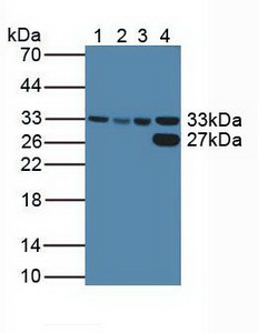CDK2 Antibody - Western Blot; Lane1: Human HeLa Cells; Lane2: Human HepG2 Cells; Lane3: Human K562 Cells; Lane4: Porcine Liver Tissue.