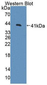 CDK2 Antibody - Western blot of CDK2 antibody.