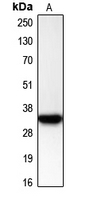 CDK2 Antibody - Western blot analysis of CDK2 expression in Jurkat (A) whole cell lysates.