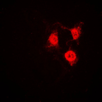 CDK2 Antibody - Immunofluorescent analysis of CDK2 staining in Jurkat cells. Formalin-fixed cells were permeabilized with 0.1% Triton X-100 in TBS for 5-10 minutes and blocked with 3% BSA-PBS for 30 minutes at room temperature. Cells were probed with the primary antibody in 3% BSA-PBS and incubated overnight at 4 C in a humidified chamber. Cells were washed with PBST and incubated with a DyLight 594-conjugated secondary antibody (red) in PBS at room temperature in the dark. DAPI was used to stain the cell nuclei (blue).