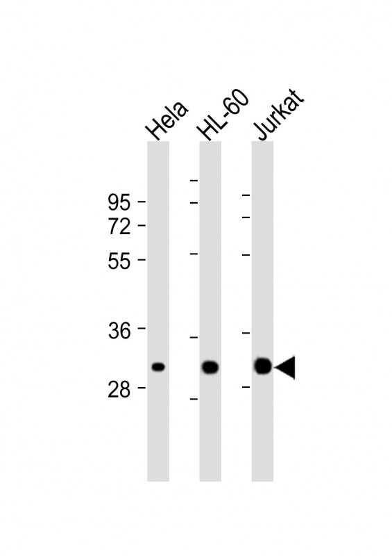 CDK2 Antibody - All lanes: Anti-CDK2 Antibody at 1:2000 dilution. Lane 1: HeLa whole cell lysate. Lane 2: HL-60 whole cell lysate. Lane 3: Jurkat whole cell lysate Lysates/proteins at 20 ug per lane. Secondary Goat Anti-mouse IgG, (H+L), Peroxidase conjugated at 1:10000 dilution. Predicted band size: 34 kDa. Blocking/Dilution buffer: 5% NFDM/TBST.