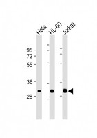 CDK2 Antibody - All lanes: Anti-CDK2 Antibody at 1:2000 dilution. Lane 1: HeLa whole cell lysate. Lane 2: HL-60 whole cell lysate. Lane 3: Jurkat whole cell lysate Lysates/proteins at 20 ug per lane. Secondary Goat Anti-mouse IgG, (H+L), Peroxidase conjugated at 1:10000 dilution. Predicted band size: 34 kDa. Blocking/Dilution buffer: 5% NFDM/TBST.