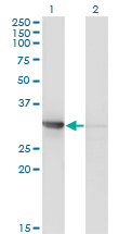 CDK2 Antibody - Western Blot analysis of CDK2 expression in transfected 293T cell line by CDK2 monoclonal antibody (M01A), clone 3A2-3G6.Lane 1: CDK2 transfected lysate (Predicted MW: 33.9 KDa).Lane 2: Non-transfected lysate.