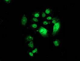 CDK2 Antibody - Anti-CDK2 mouse monoclonal antibody immunofluorescent staining of COS7 cells transiently transfected by pCMV6-ENTRY CDK2.
