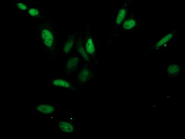 CDK2 Antibody - Immunofluorescent staining of HeLa cells using anti-CDK2 mouse monoclonal antibody.