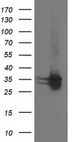 CDK2 Antibody - HEK293T cells were transfected with the pCMV6-ENTRY control (Left lane) or pCMV6-ENTRY CDK2 (Right lane) cDNA for 48 hrs and lysed. Equivalent amounts of cell lysates (5 ug per lane) were separated by SDS-PAGE and immunoblotted with anti-CDK2.