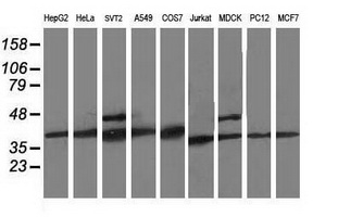 CDK2 Antibody - Western blot of extracts (35ug) from 9 different cell lines by using anti-CDK2 monoclonal antibody.