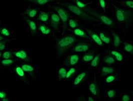 CDK2 Antibody - Immunofluorescent staining of HeLa cells using anti-CDK2 mouse monoclonal antibody.