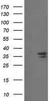 CDK2 Antibody - HEK293T cells were transfected with the pCMV6-ENTRY control (Left lane) or pCMV6-ENTRY CDK2 (Right lane) cDNA for 48 hrs and lysed. Equivalent amounts of cell lysates (5 ug per lane) were separated by SDS-PAGE and immunoblotted with anti-CDK2.