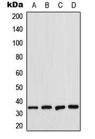 CDK2 Antibody - Western blot analysis of CDK2 expression in K562 (A); HeLa (B); NIH3T3 (C); rat heart (D) whole cell lysates.