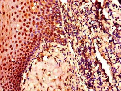 CDK2 Antibody - IHC image of CDK2 Antibody diluted at 1:800 and staining in paraffin-embedded human tonsil tissue performed on a Leica BondTM system. After dewaxing and hydration, antigen retrieval was mediated by high pressure in a citrate buffer (pH 6.0). Section was blocked with 10% normal goat serum 30min at RT. Then primary antibody (1% BSA) was incubated at 4°C overnight. The primary is detected by a biotinylated secondary antibody and visualized using an HRP conjugated SP system.