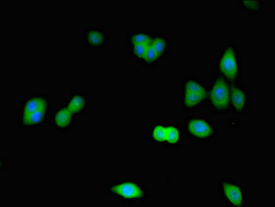 CDK2 Antibody - Immunofluorescent analysis of HepG2 cells using CDK2 Antibody at dilution of 1:100 and Alexa Fluor 488-congugated AffiniPure Goat Anti-Rabbit IgG(H+L)