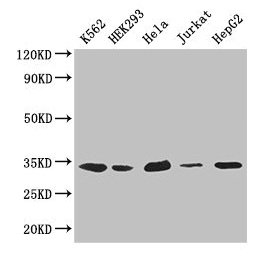 CDK2 Antibody - Western Blot Positive WB detected in: K562 whole cell lysate, HEK293 whole cell lysate, Hela whole cell lysate, Jurkat whole cell lysate, HepG2 whole cell lysate All lanes: CDK2 antibody at 2.6µg/ml Secondary Goat polyclonal to rabbit IgG at 1/50000 dilution Predicted band size: 34, 31 kDa Observed band size: 34 kDa