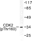 CDK2 Antibody - Western blot of p-CDK2 (T160) pAb in extracts from A2780 cells.