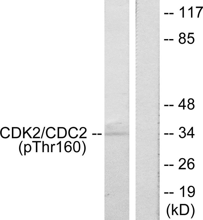 CDK2 Antibody - Western blot analysis of lysates from A2780 cells, using CDK2 (Phospho-Thr160) Antibody. The lane on the right is blocked with the phospho peptide.