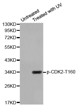 CDK2 Antibody - Western blot analysis of extracts from Hela cells.