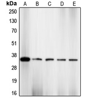 CDK2 Antibody - Western blot analysis of CDK2 (pT160) expression in NIH3T3 (A); HeLa (B); COLO205 (C); K562 (D); A2780 (E) whole cell lysates.