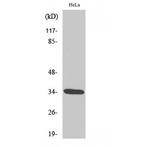 CDK2 Antibody - Western blot of Phospho-Cdk2 (T160) antibody