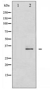CDK2 Antibody - Western blot of CDK2 phosphorylation expression in A2780 whole cell lysates,The lane on the left is treated with the antigen-specific peptide.