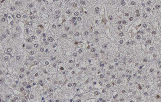 CDK2 Antibody - 1:200 staining human lymph nodes tissue by IHC-P. The tissue was formaldehyde fixed and a heat mediated antigen retrieval step in citrate buffer was performed. The tissue was then blocked and incubated with the antibody for 1.5 hours at 22°C. An HRP conjugated goat anti-rabbit antibody was used as the secondary.