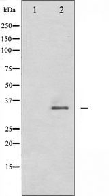 CDK2 Antibody - Western blot analysis of CDK2 phosphorylation expression in A2780 whole cells lysates. The lane on the left is treated with the antigen-specific peptide.