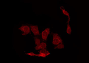 CDK2 Antibody - Staining A2780 cells by IF/ICC. The samples were fixed with PFA and permeabilized in 0.1% Triton X-100, then blocked in 10% serum for 45 min at 25°C. The primary antibody was diluted at 1:200 and incubated with the sample for 1 hour at 37°C. An Alexa Fluor 594 conjugated goat anti-rabbit IgG (H+L) Ab, diluted at 1/600, was used as the secondary antibody.