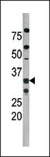 CDK2 Antibody - The anti-Phospho-Cdk2-T160 antibody is used in Western blot to detect Phospho-Cdk2-T160 in A2058 tissue lysate