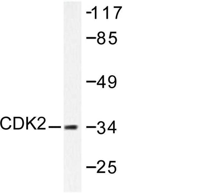 CDK2 Antibody - Western blot of CDK2 (V154) pAb in extracts from A2780 cells.