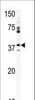 CDK20 / CCRK Antibody - Western blot of anti-CCRK antibody in mouse kidney tissue lysate (35 ug/lane). CCRK(arrow) was detected using the purified antibody.