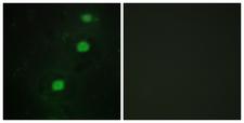 CDK20 / CCRK Antibody - Immunofluorescence analysis of HUVEC cells, using CCRK Antibody. The picture on the right is blocked with the synthesized peptide.