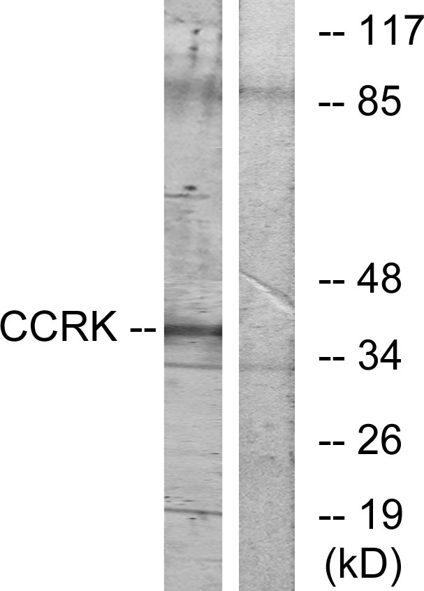 CDK20 / CCRK Antibody - Western blot analysis of lysates from RAW264.7 cells, using CCRK Antibody. The lane on the right is blocked with the synthesized peptide.