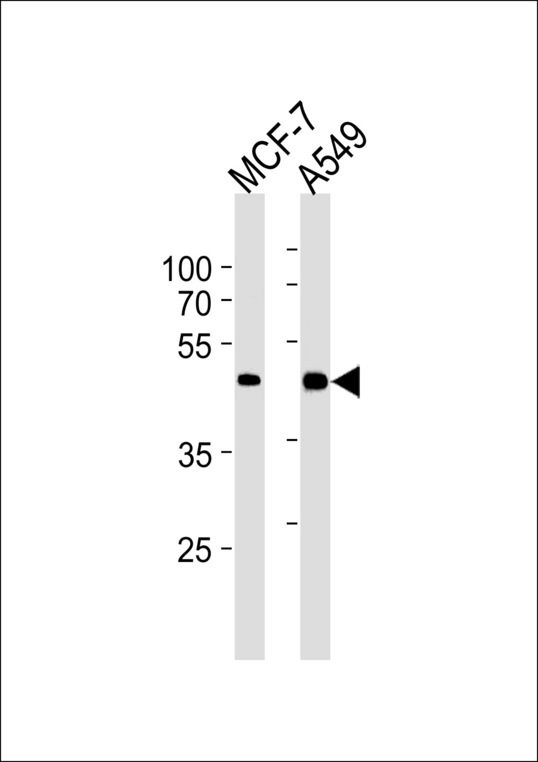 CDK20 / CCRK Antibody - CCRK Antibody western blot of MCF-7,A549 cell line lysates (35 ug/lane). The CCRK antibody detected the CCRK protein (arrow).