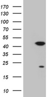 CDK20 / CCRK Antibody - HEK293T cells were transfected with the pCMV6-ENTRY control. (Left lane) or pCMV6-ENTRY CDK20. (Right lane) cDNA for 48 hrs and lysed. Equivalent amounts of cell lysates. (5 ug per lane) were separated by SDS-PAGE and immunoblotted with anti-CDK20. (1:2000)