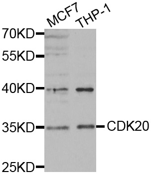 CDK20 / CCRK Antibody - Western blot analysis of extracts of various cell lines.