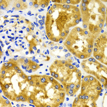 CDK20 / CCRK Antibody - Immunohistochemistry of paraffin-embedded Human kidney tissue.