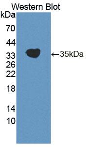 CDK20 / CCRK Antibody - Western Blot; Sample: Recombinant protein.