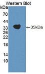 CDK20 / CCRK Antibody - Western Blot; Sample: Recombinant protein.