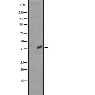 CDK20 / CCRK Antibody - Western blot analysis of CCRK expression in RPMI-8226 cells lysate;. The lane on the left is treated with the antigen-specific peptide.