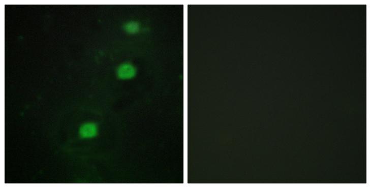 CDK20 / CCRK Antibody - Peptide - + Immunofluorescence analysis of HUVEC cells, using CCRK antibody.