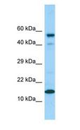 CDK2AP1 / DOC1 Antibody - DOC-1 / CDK2AP1 antibody Western Blot of HeLa.  This image was taken for the unconjugated form of this product. Other forms have not been tested.