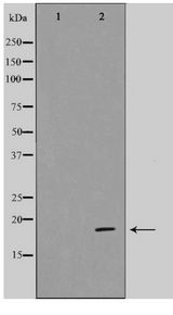 CDK2AP1 / DOC1 Antibody - Western blot of HeLa cell lysate using CDKAP1 Antibody