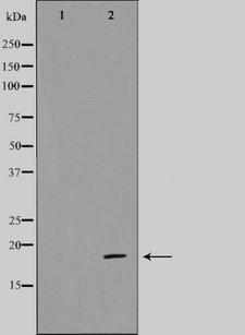 CDK2AP1 / DOC1 Antibody - Western blot analysis on HeLa cell lysates using CDKAP1 antibody. The lane on the left is treated with the antigen-specific peptide.