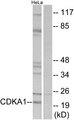 CDK2AP1 / DOC1 Antibody - Western blot analysis of extracts from HeLa cells, using CDKA1antibody.