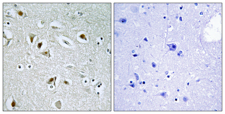 CDK2AP2 Antibody - Immunohistochemistry analysis of paraffin-embedded human brain tissue, using CDKA2 Antibody. The picture on the right is blocked with the synthesized peptide.