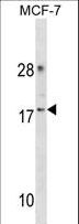 CDK2AP2 Antibody - CDK2AP2 Antibody western blot of MCF-7 cell line lysates (35 ug/lane). The CDK2AP2 antibody detected the CDK2AP2 protein (arrow).