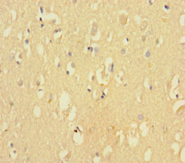 CDK2AP2 Antibody - Immunohistochemistry of paraffin-embedded human brain tissue using CDK2AP2 Antibody at dilution of 1:100