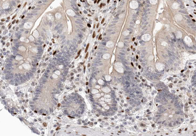 CDK2AP2 Antibody - 1:100 staining human colon tissue by IHC-P. The tissue was formaldehyde fixed and a heat mediated antigen retrieval step in citrate buffer was performed. The tissue was then blocked and incubated with the antibody for 1.5 hours at 22°C. An HRP conjugated goat anti-rabbit antibody was used as the secondary.